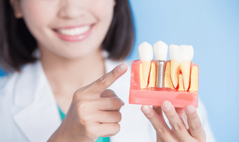 The Ultimate Guide to Dental Implant Aftercare
