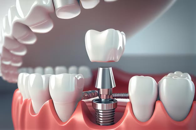 Dental Implants procedure in Madison